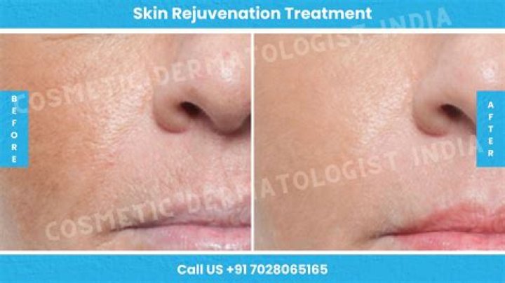 A Journey To Skin Rejuvenation