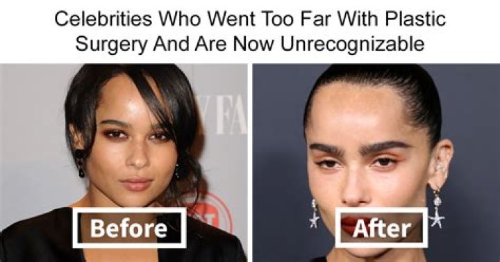 Before And After Plastic Surgery Insights