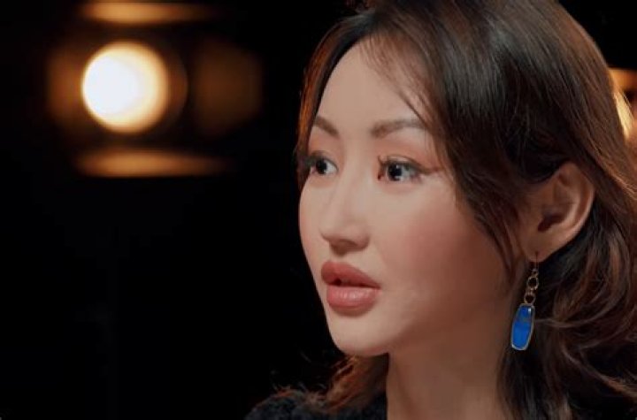 Understanding The Controversy Surrounding Surgery Yeonmi Park